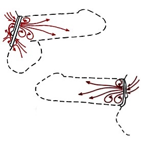  - Cock Rings